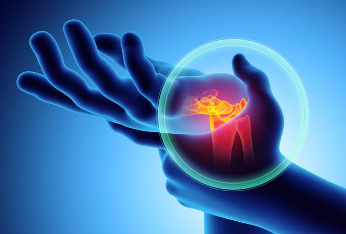 Jak mám postupovat, když chci jít na bezplatné vyšetření kloubů? 